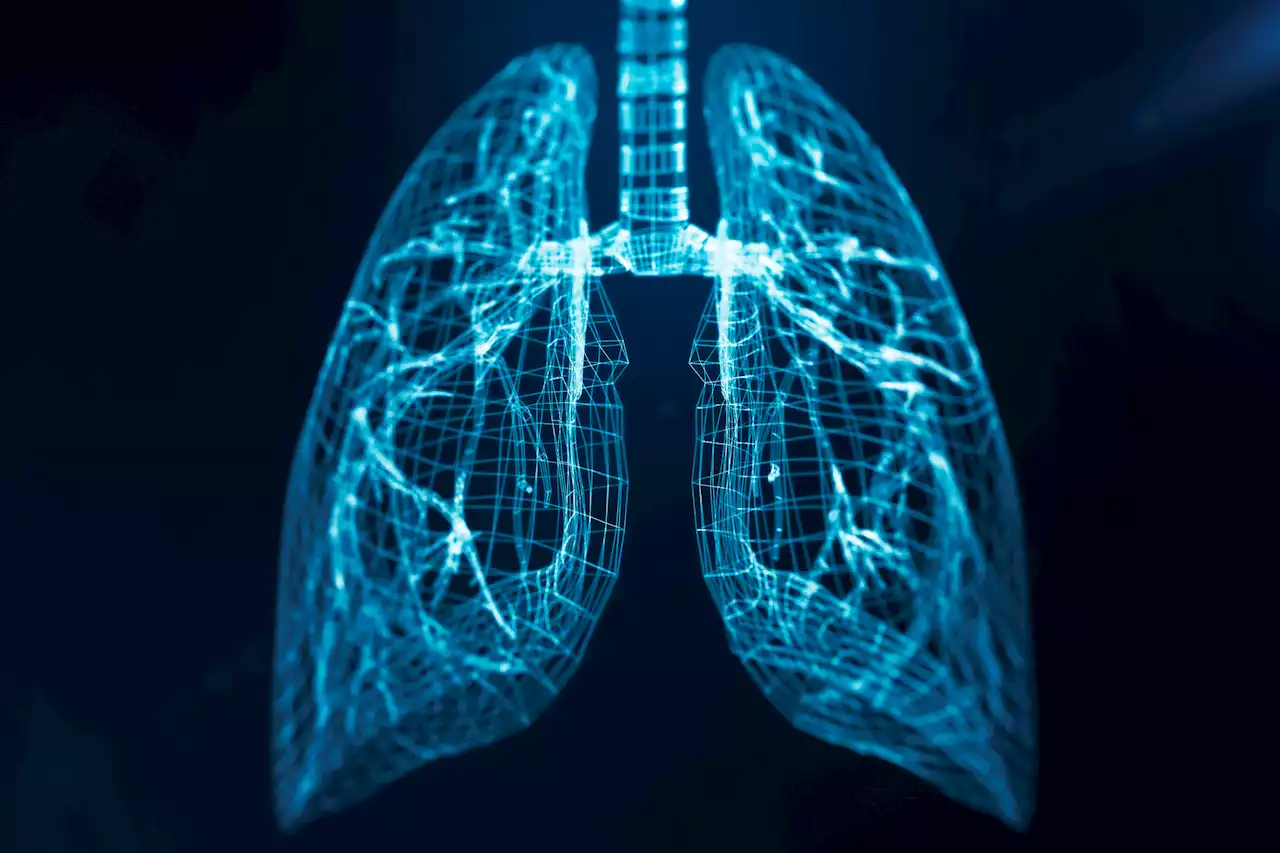 Lung Cancer Screening Can Catch Tumors When They're Curable, New Research Finds