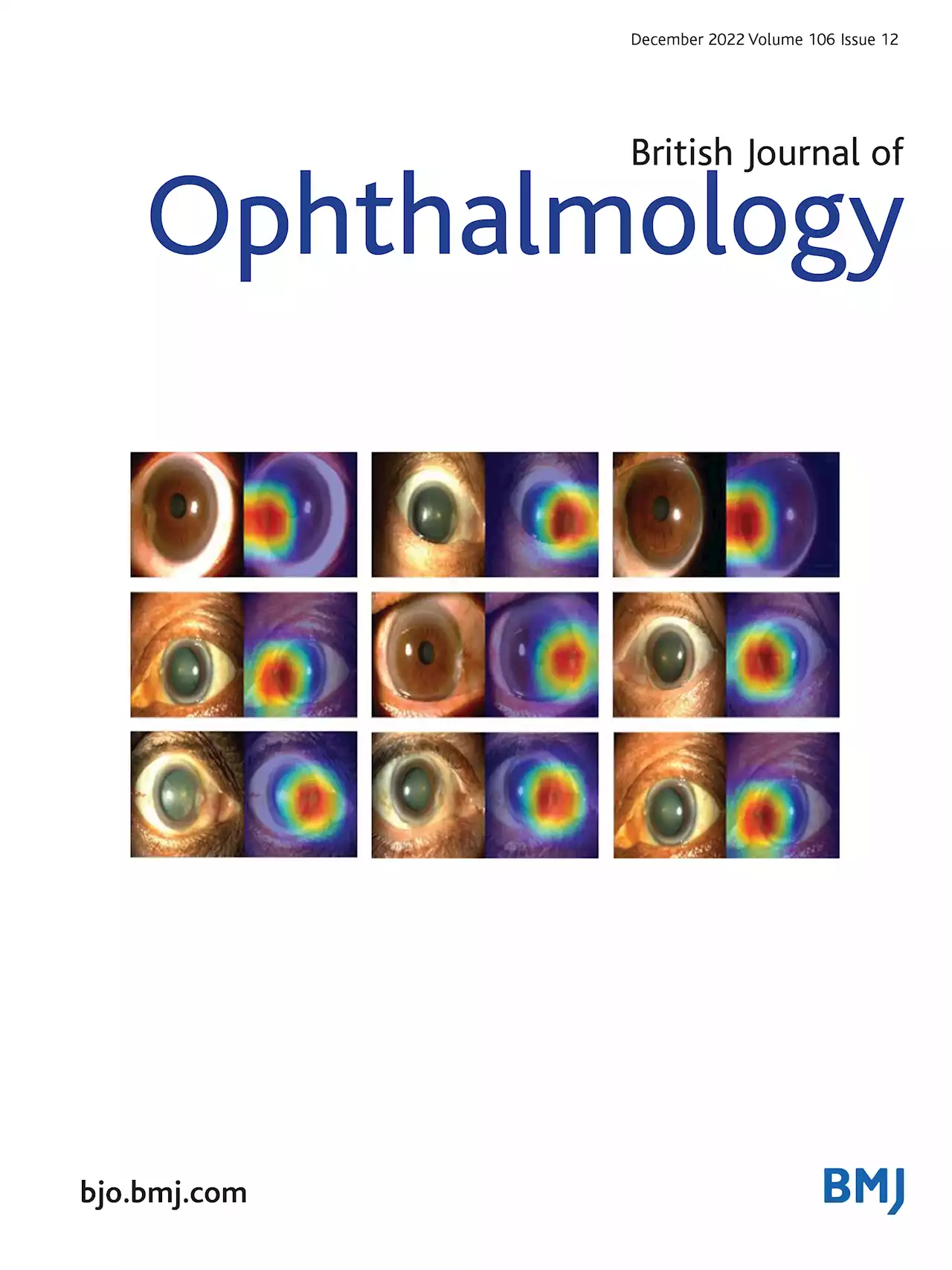 Artificial intelligence-enabled retinal vasculometry for prediction of circulatory mortality, myocardial infarction and stroke