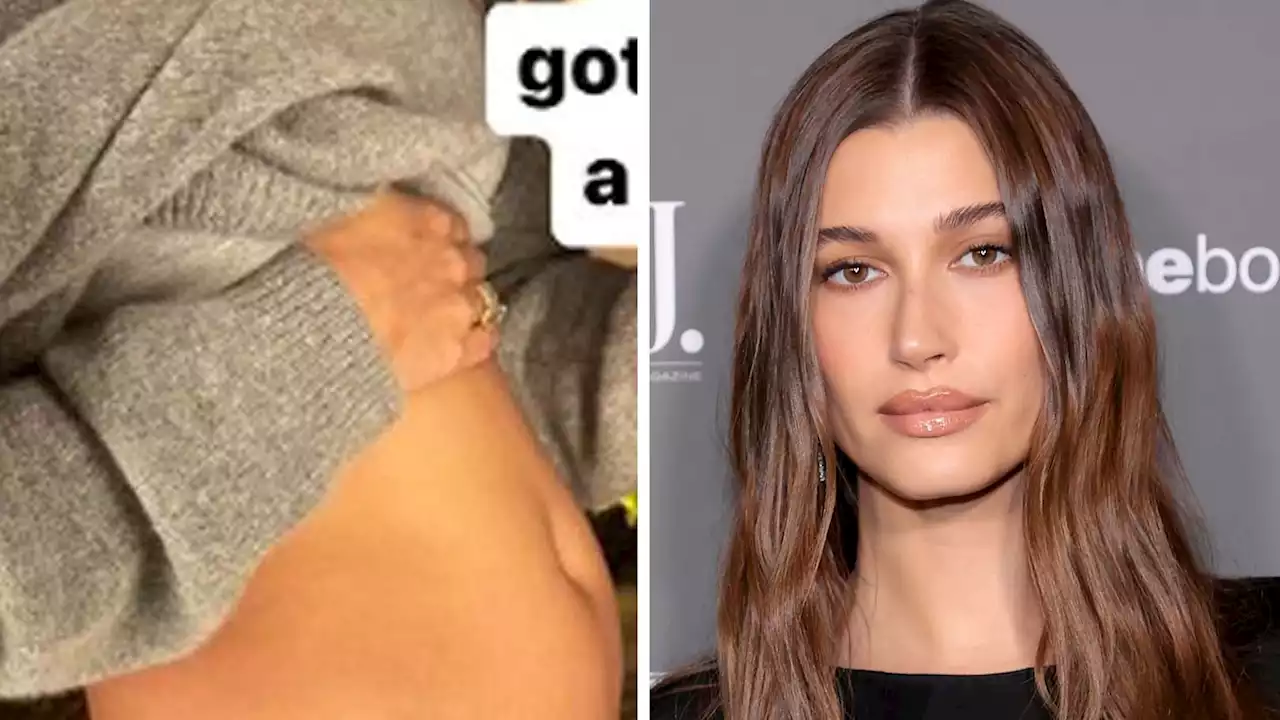 Hailey Bieber Reveals She Has Ovarian Cyst 'Size of an Apple'