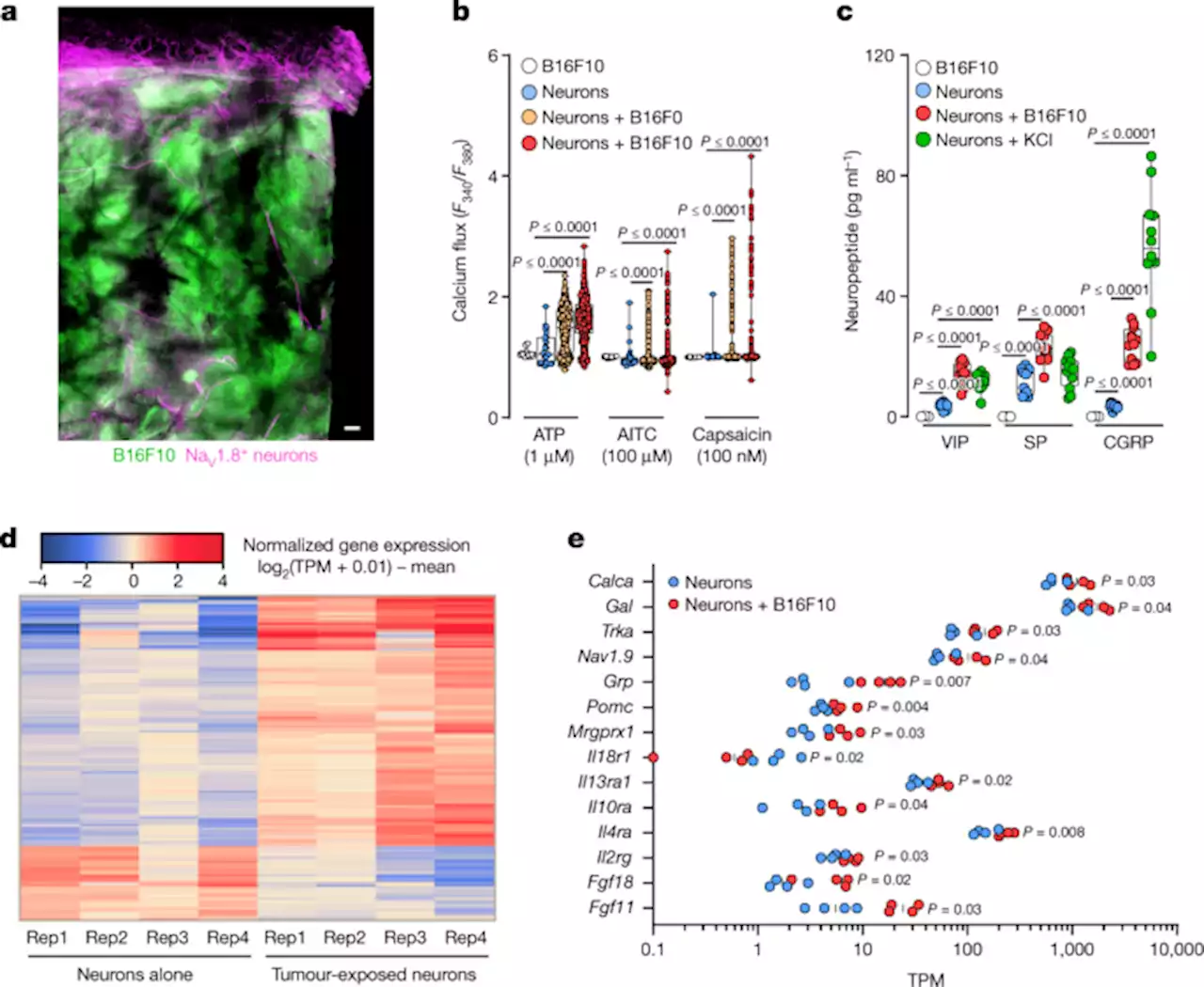 Nociceptor neurons affect cancer immunosurveillance - Nature
