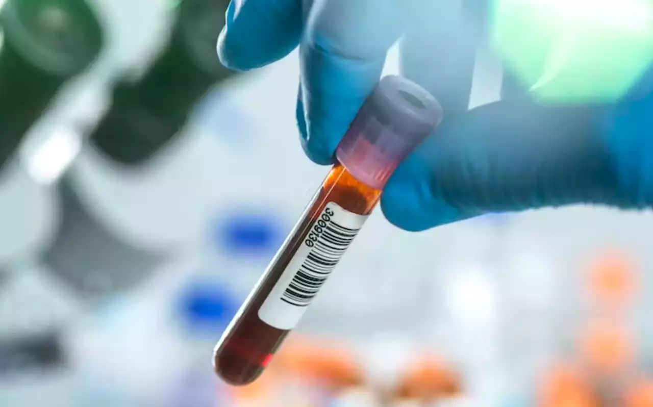 A blood test that screens for multiple cancers at once promises to boost early detection | Opinion