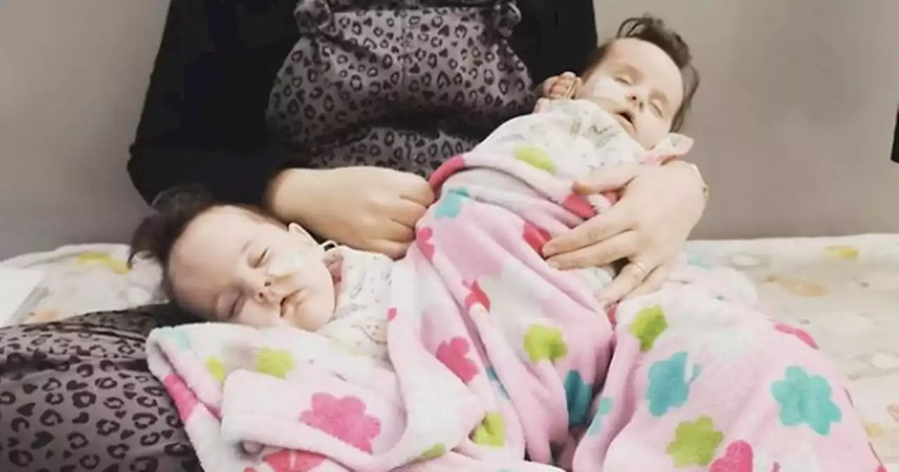 Formerly conjoined twins heading home from hospital in time for Christmas