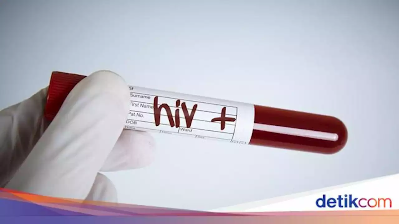 4 Cara Penyebaran HIV-AIDS, Hati-hati yang Doyan Seks Oral!