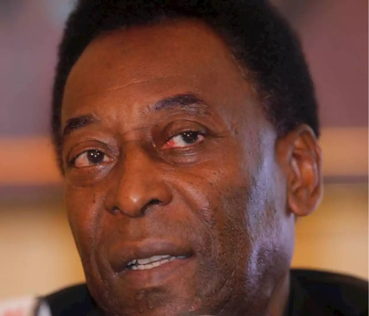 Atención: Pelé es internado en un hospital de Brasil