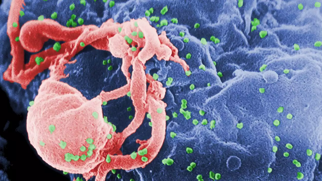 Creepy HIV memory forces a patient's immune system to keep him always sick