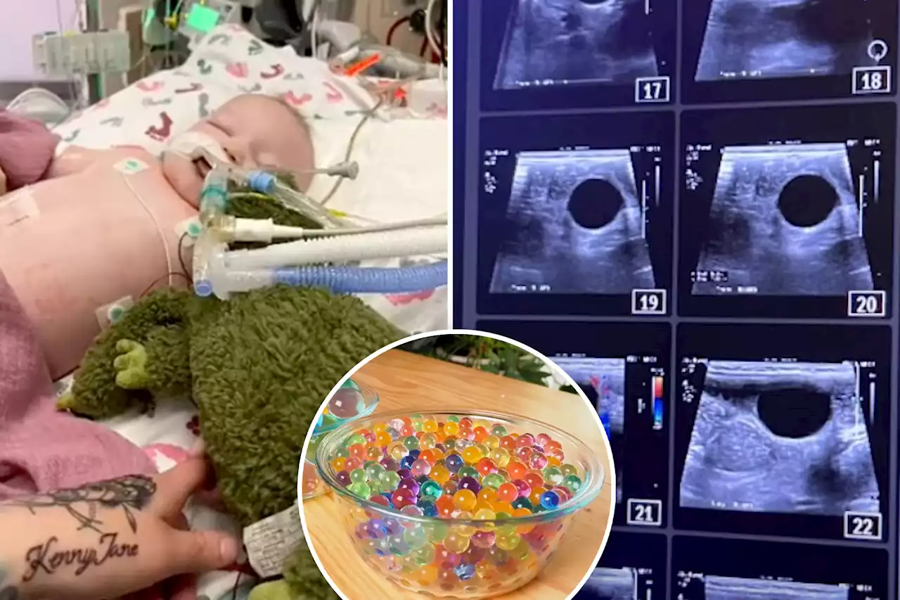 My baby swallowed a water bead and nearly died — parents should beware