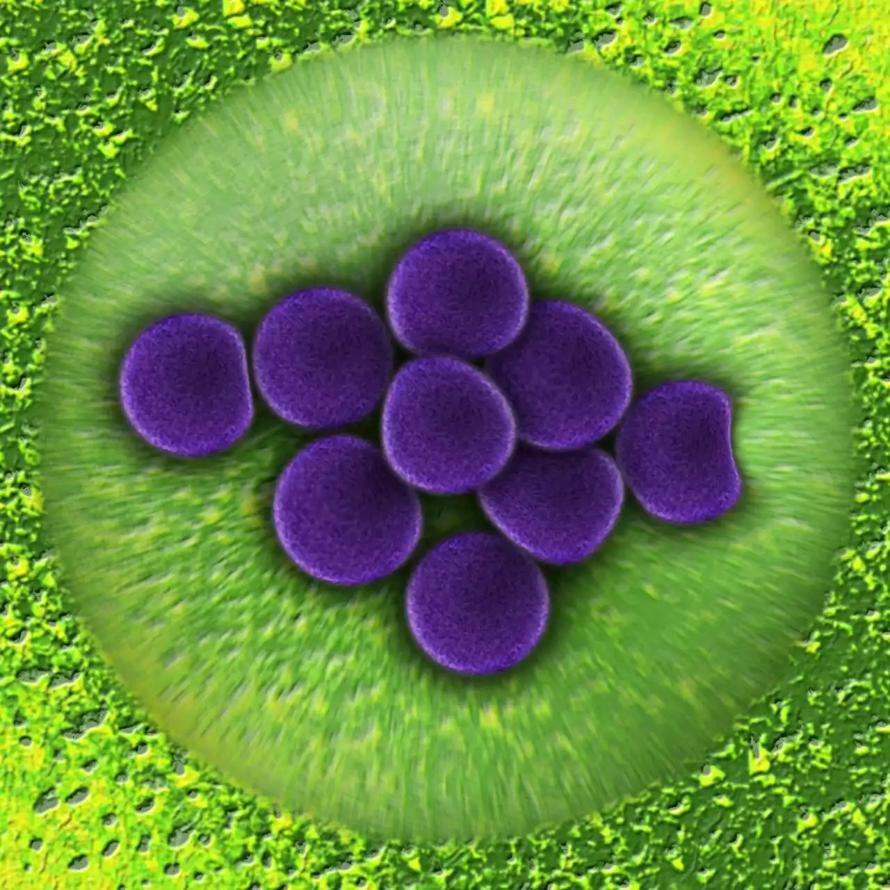 Researchers discover new form of antimicrobial resistance