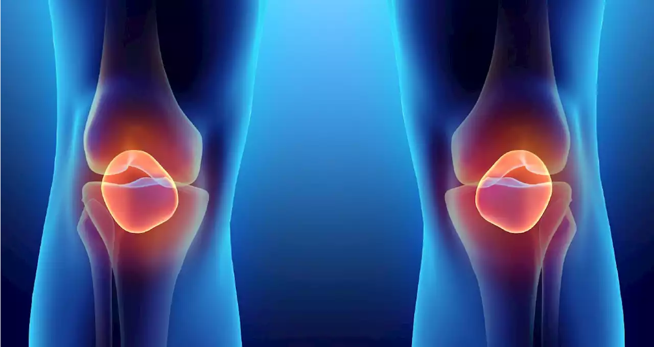 Steroid Shots May Worsen Knee Arthritis: Study