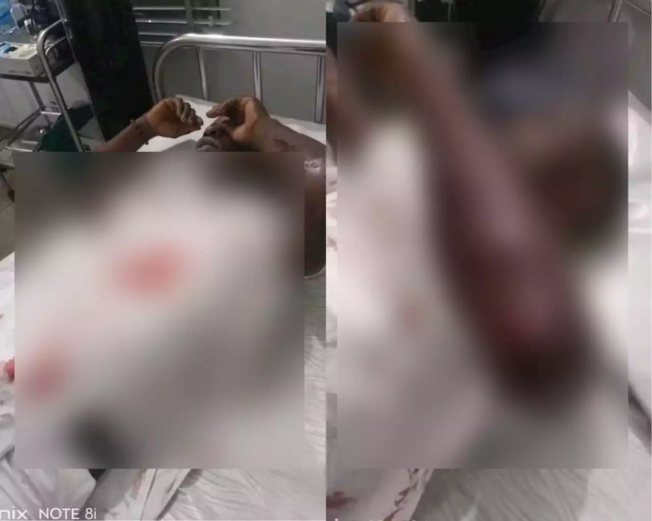 Governor Wike's Alleged Thugs Machete, Shoot PDP Member For Pasting Atiku’s Posters In Rivers | Sahara Reporters
