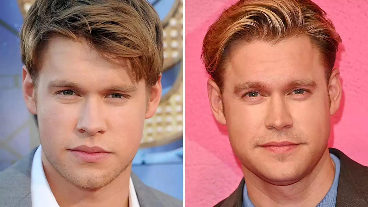 Chord Overstreet -- Good Genes Or Good Docs?!