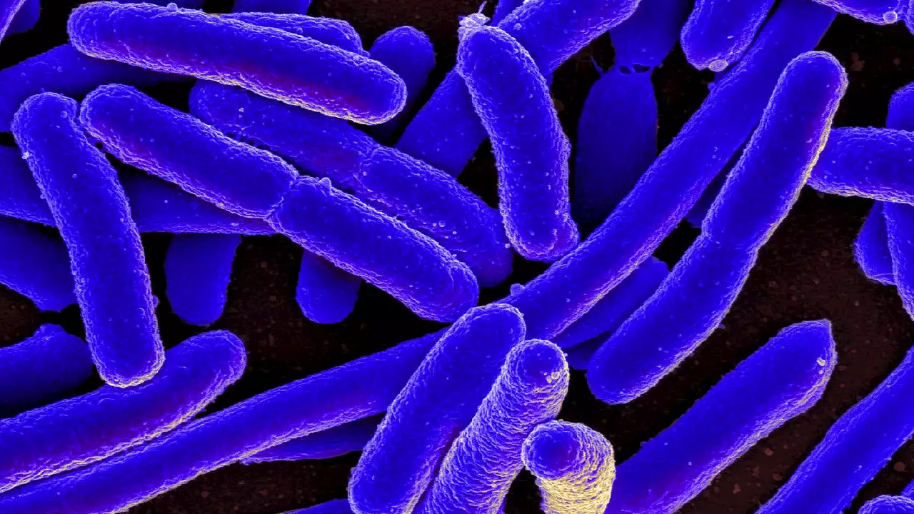 Health officials investigating E. coli outbreak in King County