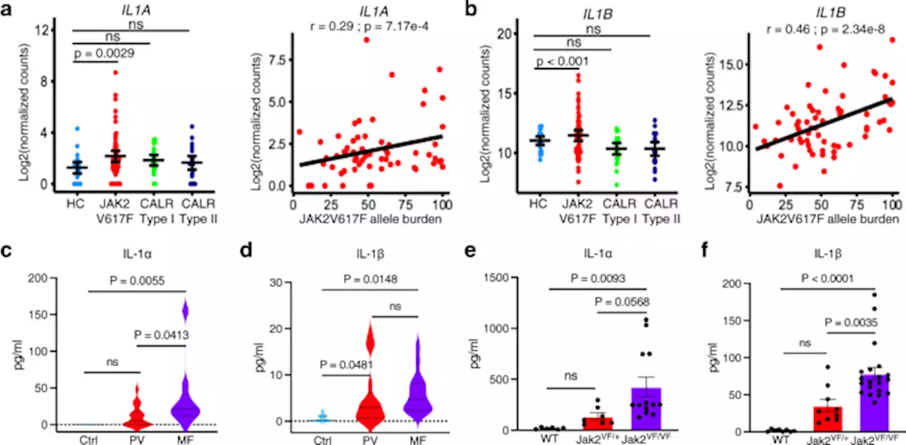 Interleukin-1 contributes to clonal expansion and progression of bone marrow fibrosis in JAK2V617F-induced myeloproliferative neoplasm - Nature Communications