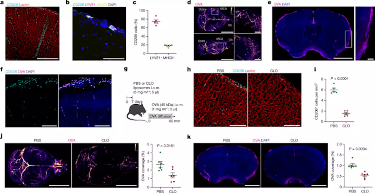 Parenchymal border macrophages regulate the flow dynamics of the cerebrospinal fluid - Nature