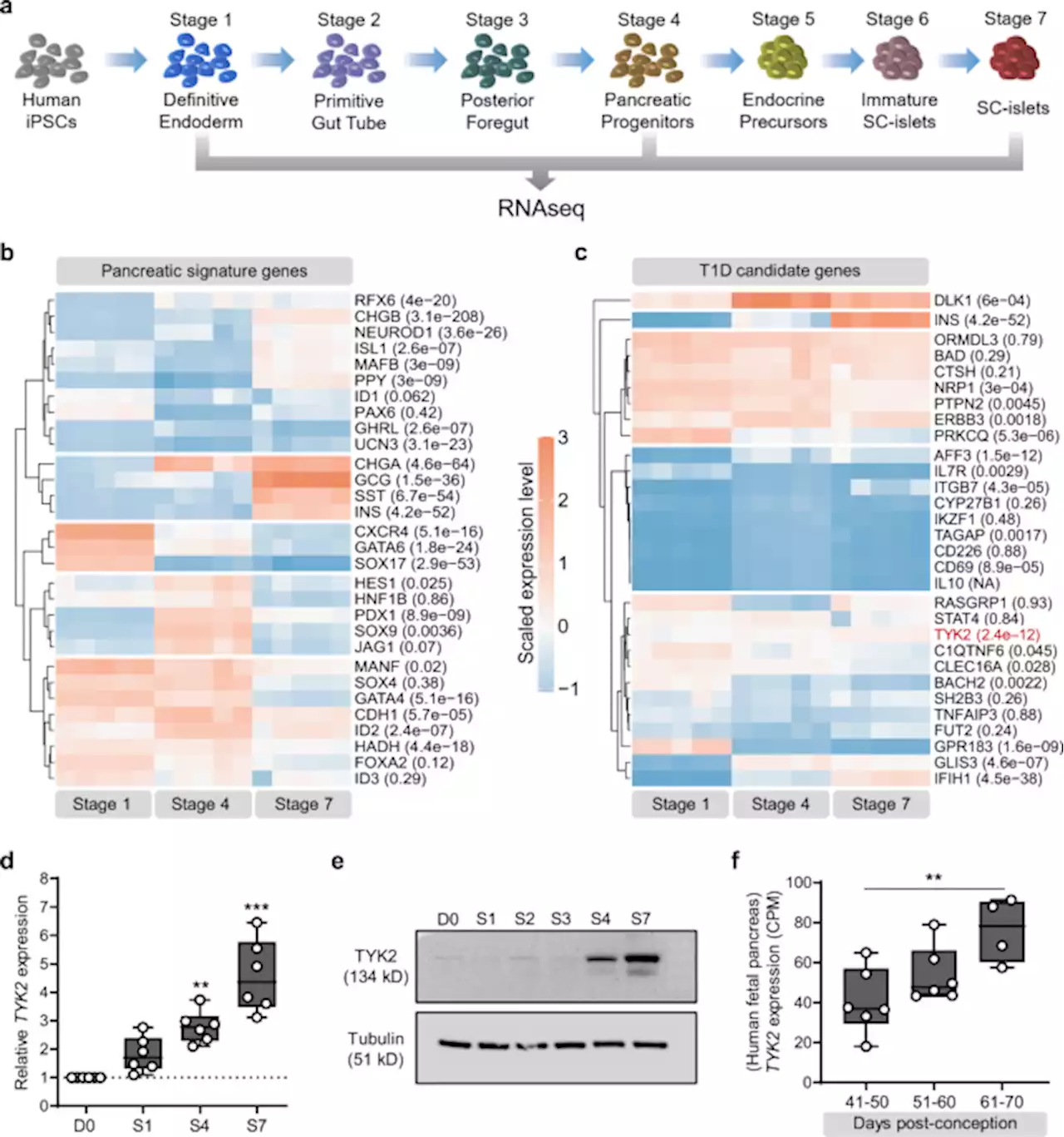 The type 1 diabetes gene TYK2 regulates β-cell development and its responses to interferon-α - Nature Communications