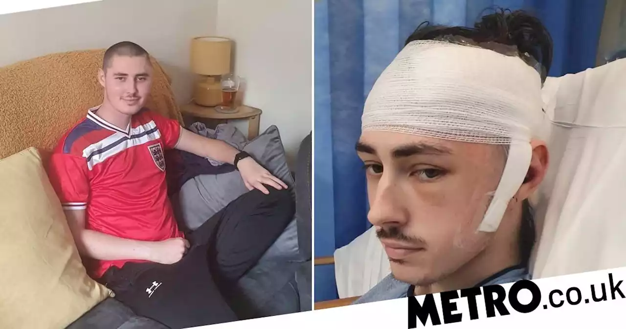 Man told to take paracetamol for his headaches actually had a brain tumour