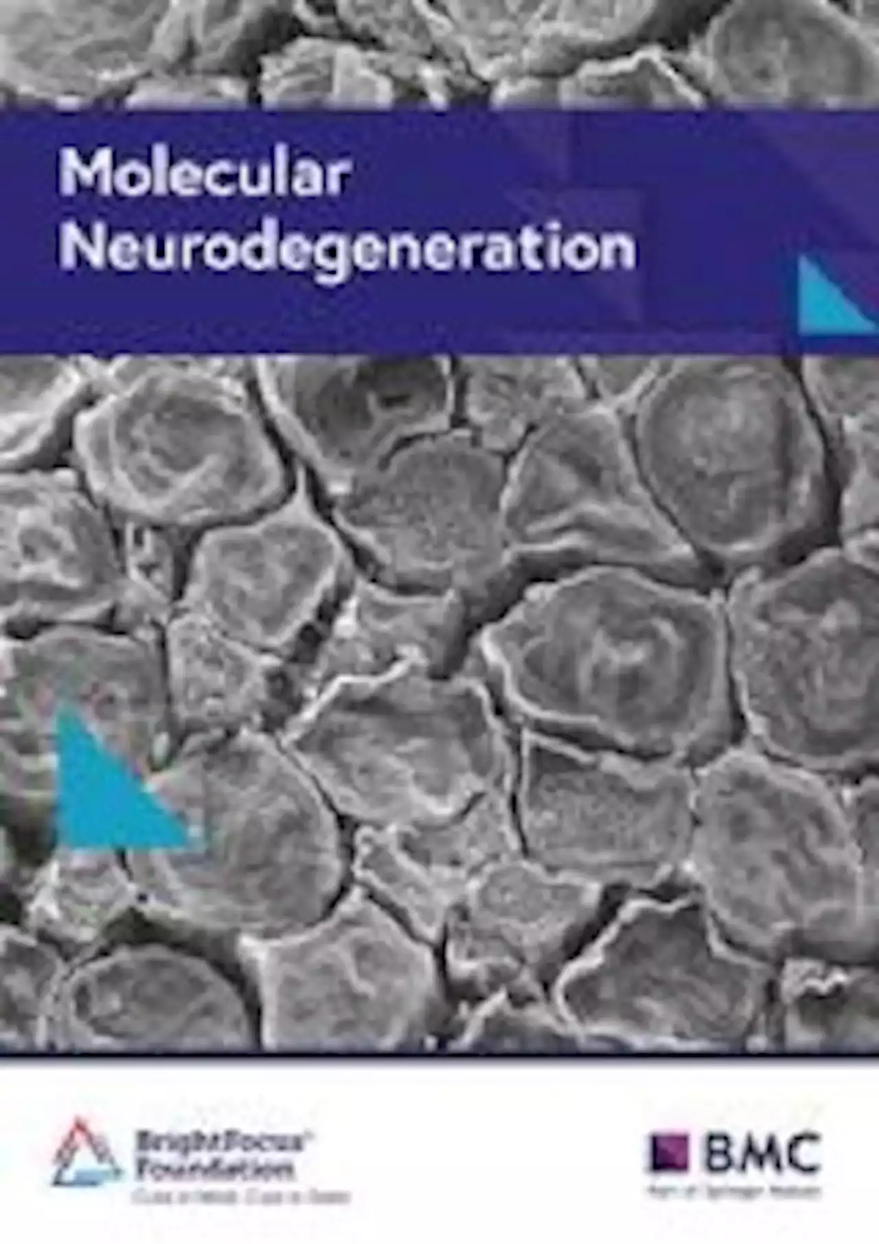 TREM2 and microglia exosomes: a potential highway for pathological tau - Molecular Neurodegeneration