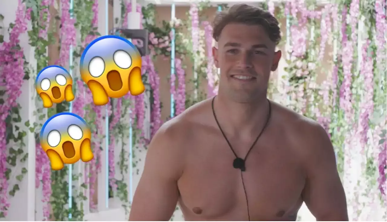 Love Island fans divided over Andrew Le Page’s new teeth