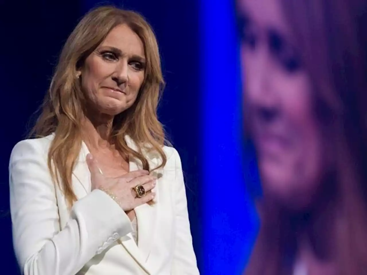 Mengenal Kelainan Neurologis yang Dialami Penyanyi Celine Dion