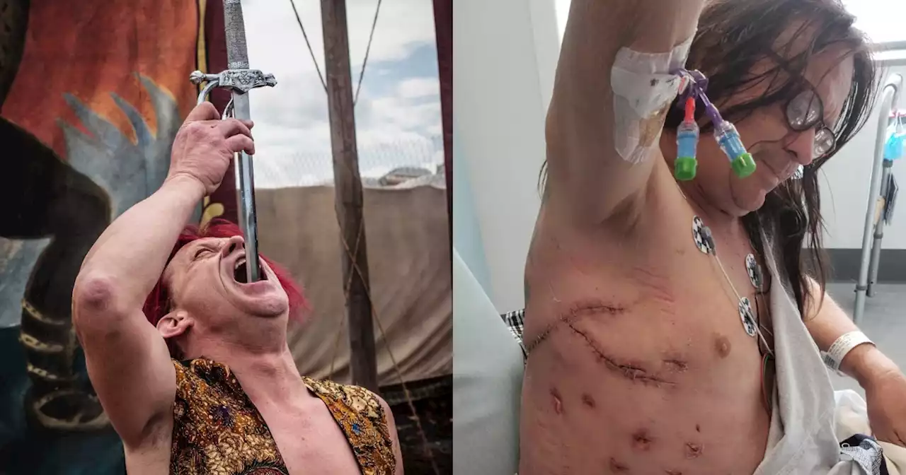 Sword swallower gets 'near fatally injured' after five-sword swallowing stunt