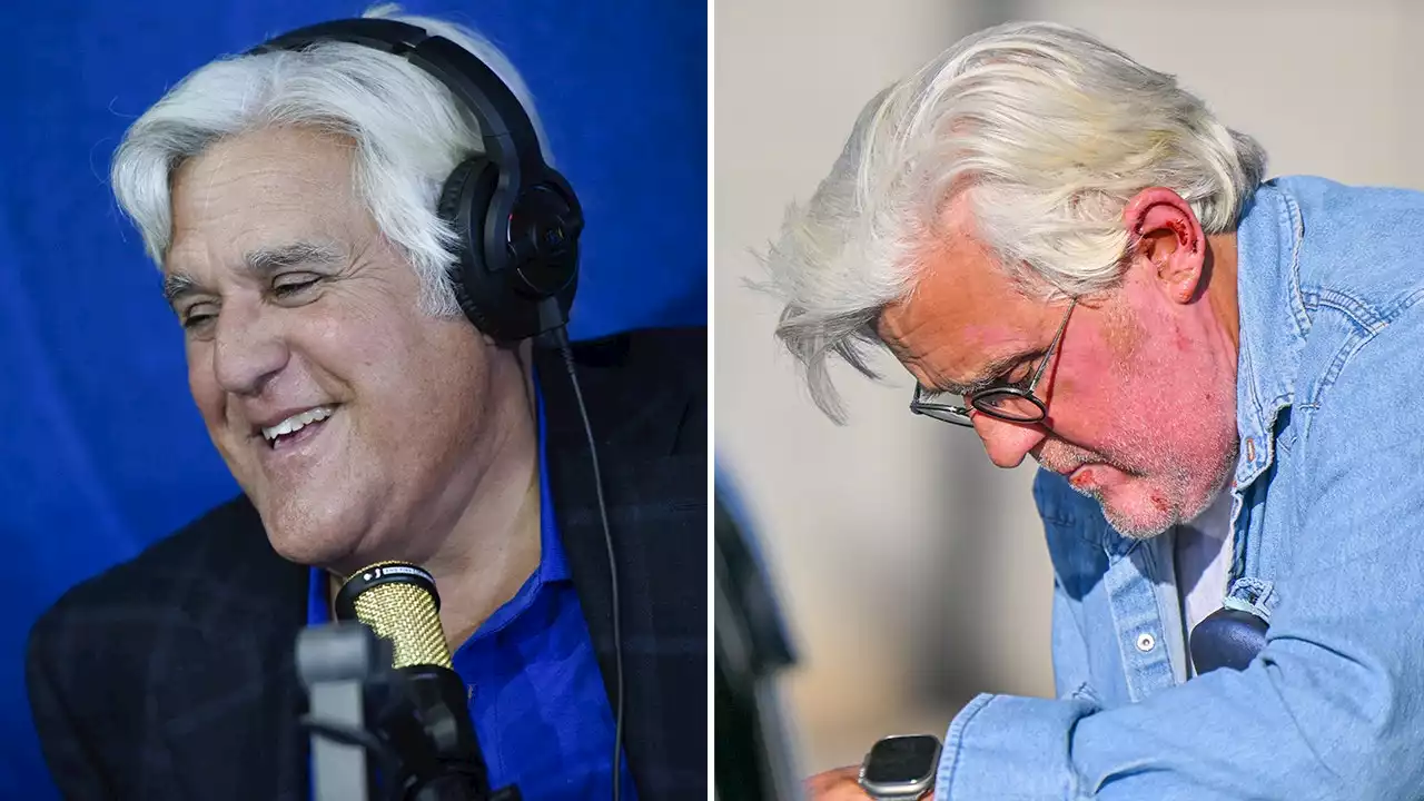 Jay Leno wants to joke about his facial burns: 'There's nothing worse than whiny celebrities'