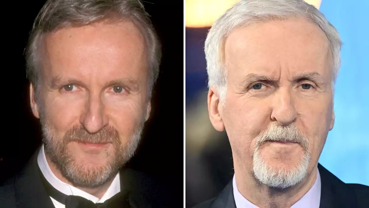 James Cameron -- Good Genes Or Good Docs?!