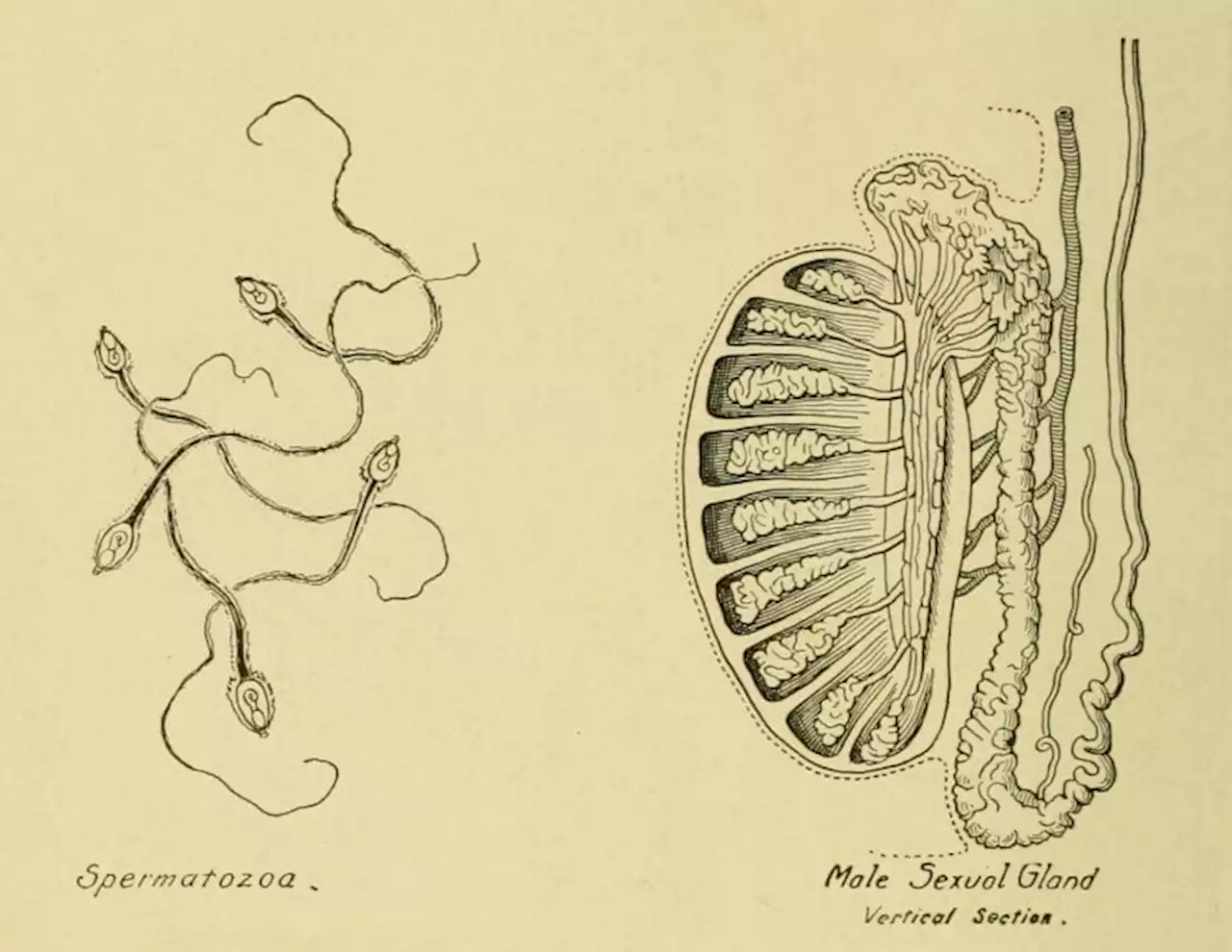 'Spermatorrhea' Was Once the Male Equivalent of “Hysteria” – And Its Cure Was Absolutely Shocking