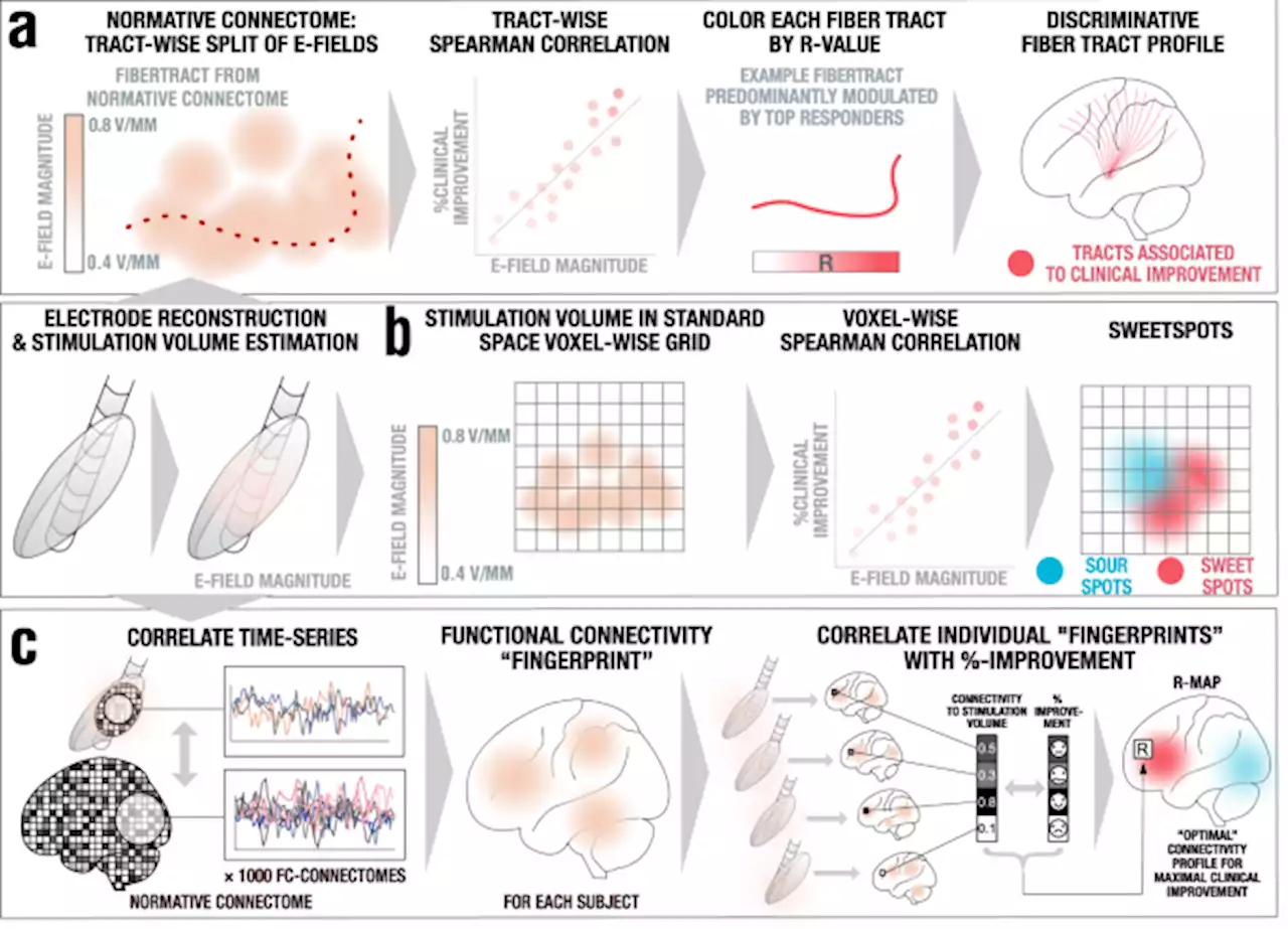 Optimal deep brain stimulation sites and networks for stimulation of the fornix in Alzheimer’s disease - Nature Communications