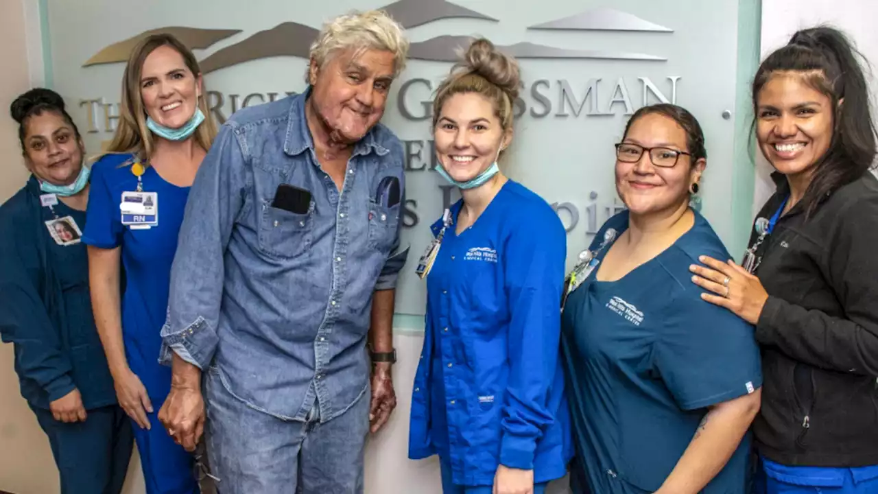 Jay Leno describes the moment his face caught on fire