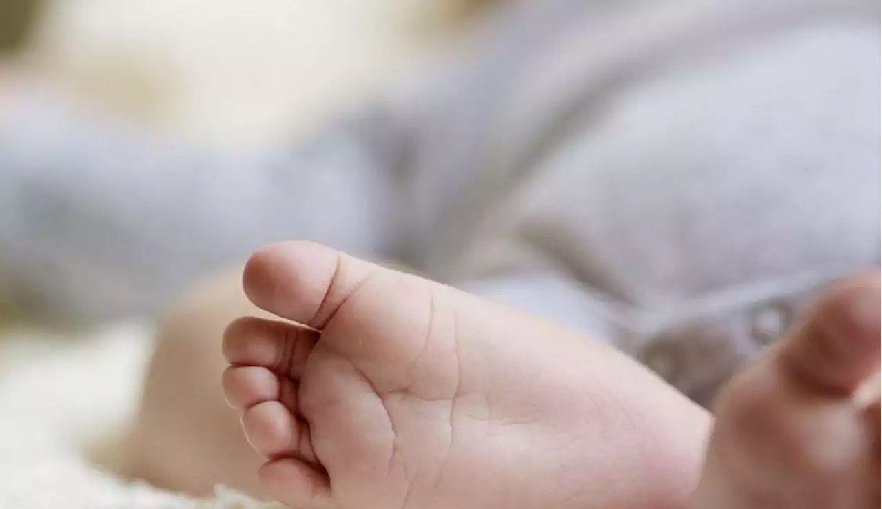 Bebé nació con una cola de 5,7 centímetros
