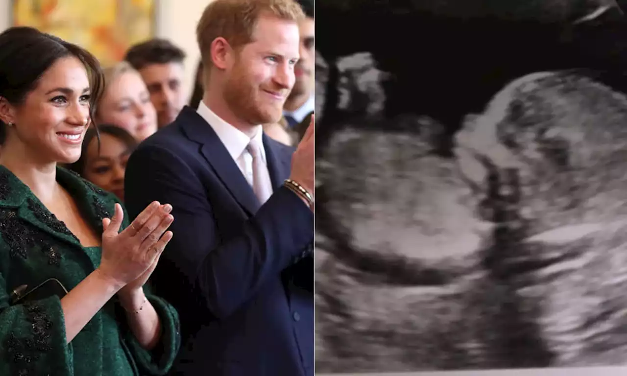 Meghan Markle and Prince Harry surprise with never-before-seen ultrasound photo