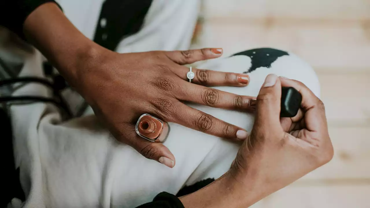 Una mujer a punto de perder el dedo tras realizarse una manicura en la que contrajo una infección