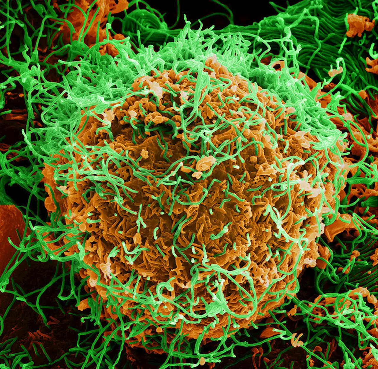 Trial on safety and immunogenicity of Ebola vaccines yields promising results