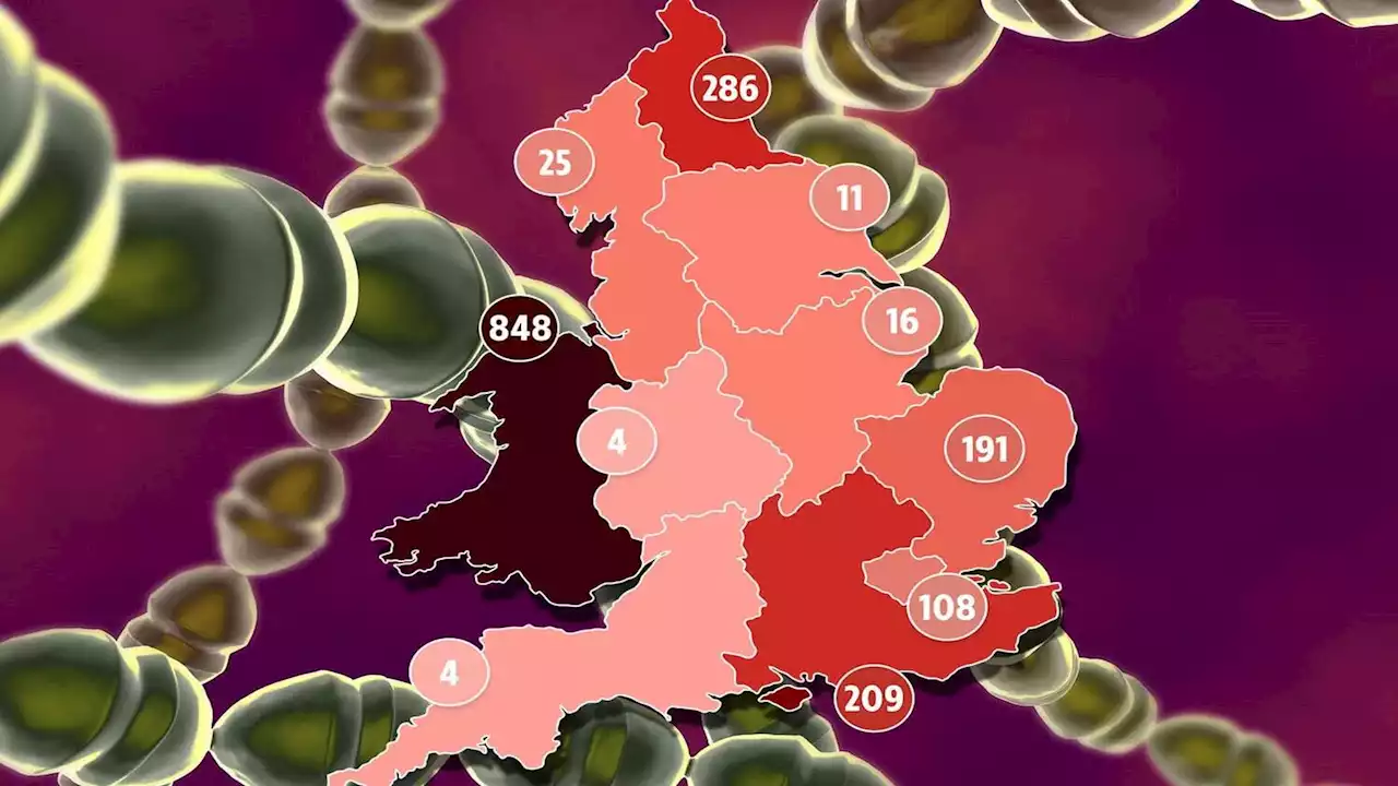 Map reveals scarlet fever hotspots as cases jump & Strep A outbreak grips UK