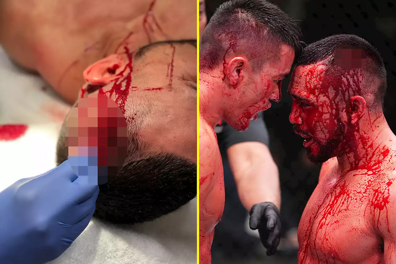 UFC fighter 'cuts artery' in bloodbath victory and took two hours to stop bleeding