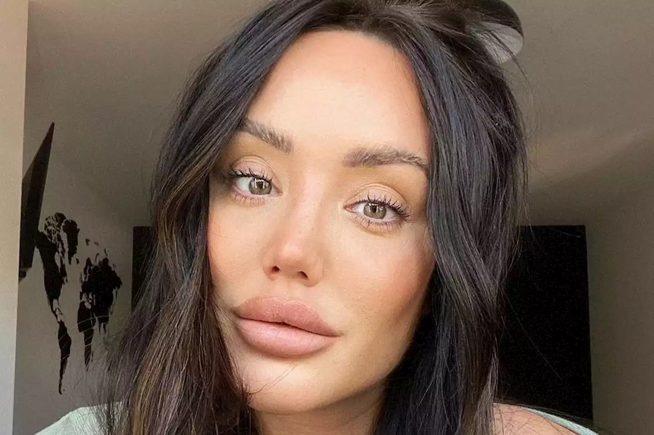 Charlotte Crosby reveals 'new face' after getting lip filler dissolved