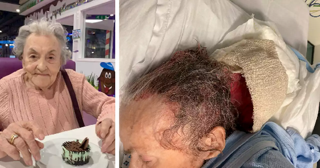 Frail dementia gran left with bloody head wound after hospital fall