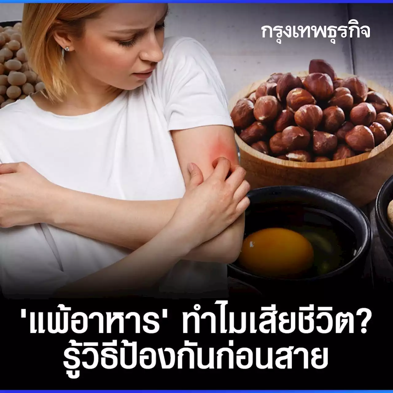 'แพ้อาหาร' ทำไมเสียชีวิต ? รู้เท่าทัน ป้องกันอันตราย