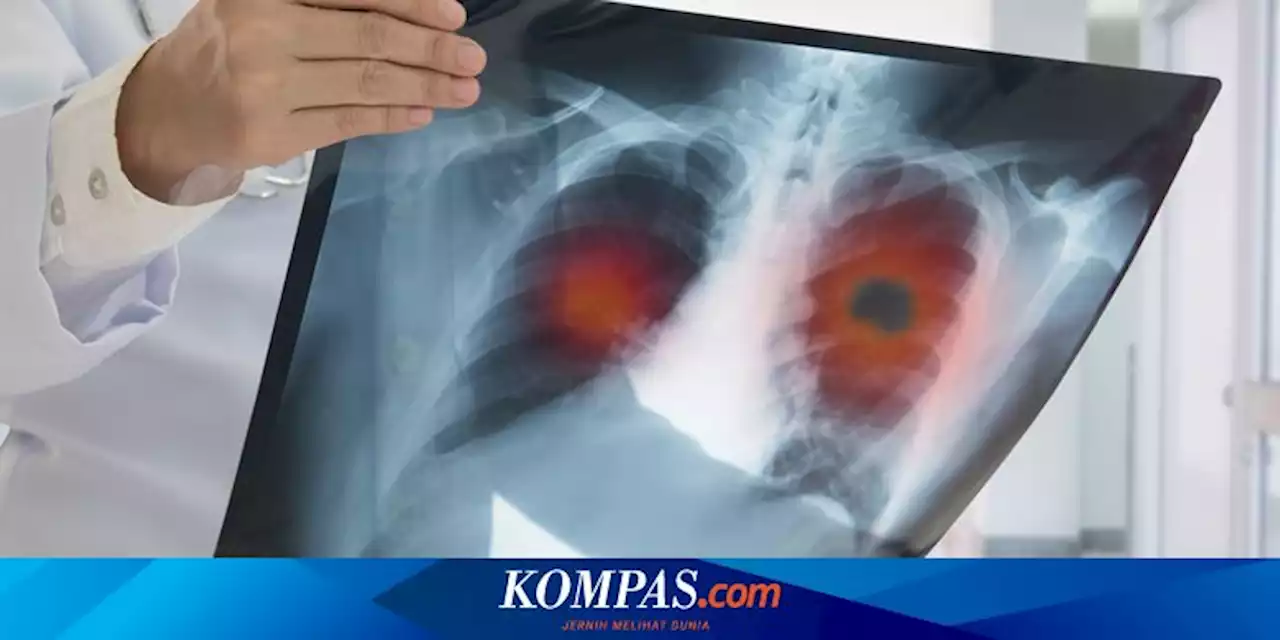 3 Jenis Penyakit Paru-paru yang Utama dan Perlu Diwaspadai