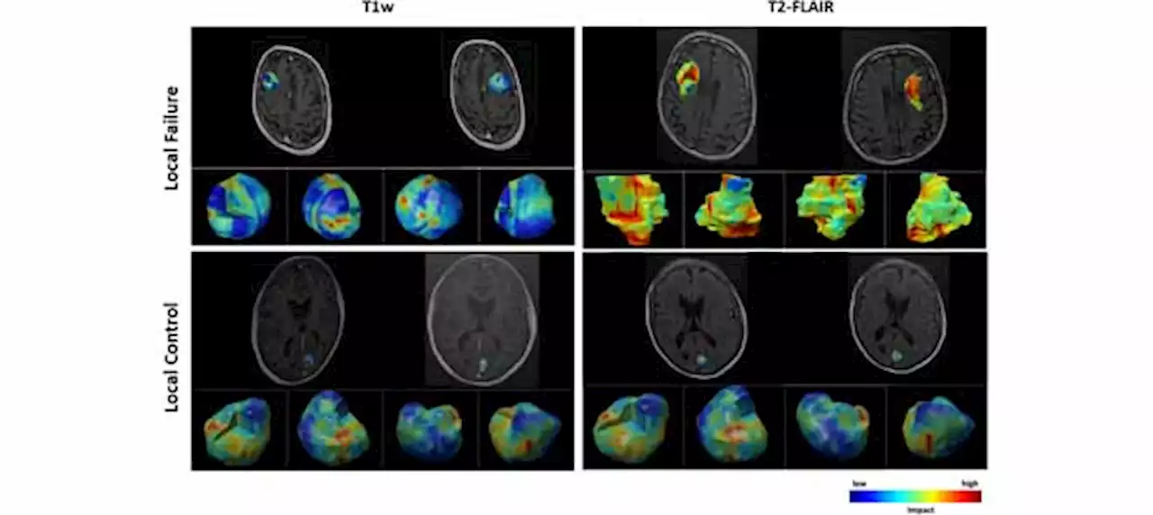 A Self-Attention-Guided 3D Deep Residual Network With Big Transfer to Predict Local Failure in Brain Metastasis After Radiotherapy Using Multi-Channel MRI