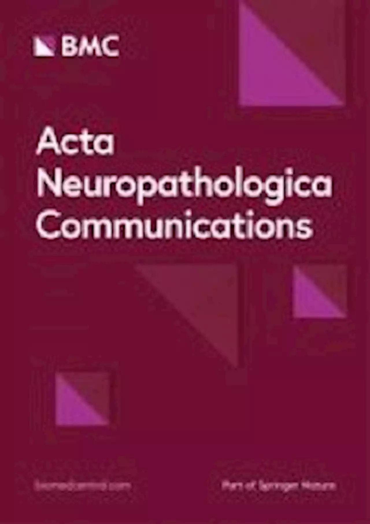 Cognitively impaired aged Octodon degus recapitulate major neuropathological features of sporadic Alzheimer’s disease - Acta Neuropathologica Communications