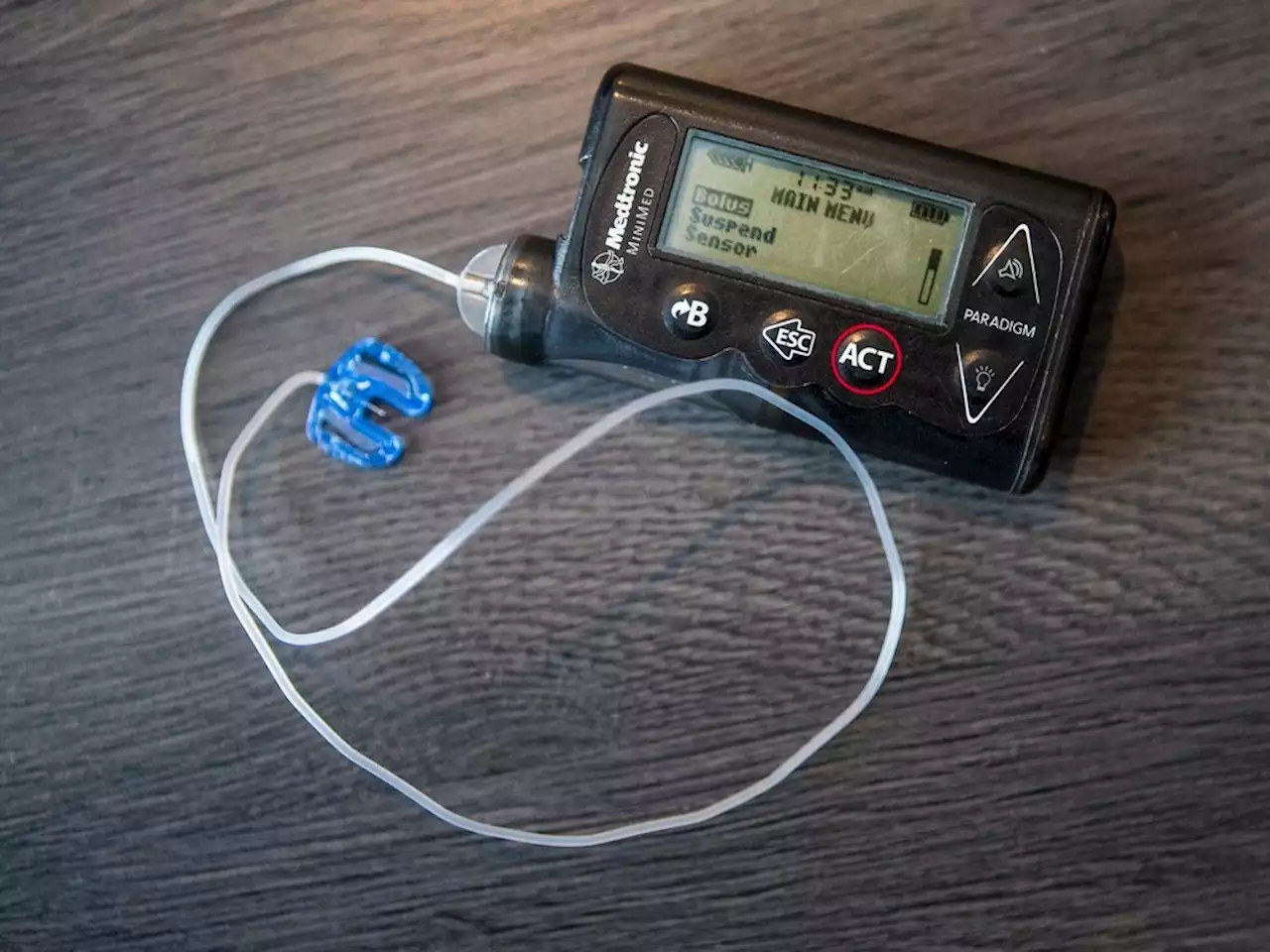 Improved insulin pumps available under Alberta program as early as Friday