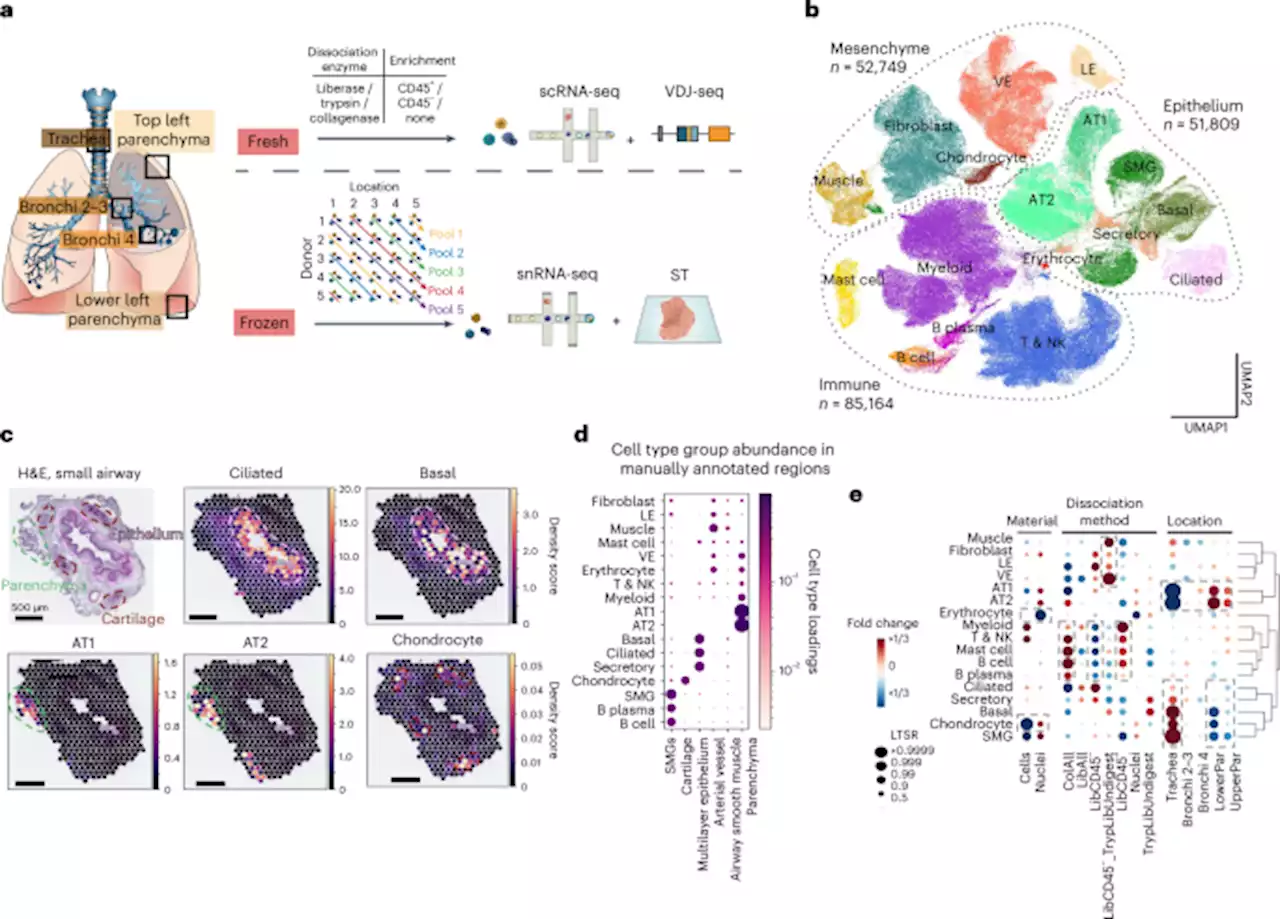 A spatially resolved atlas of the human lung characterizes a gland-associated immune niche - Nature Genetics