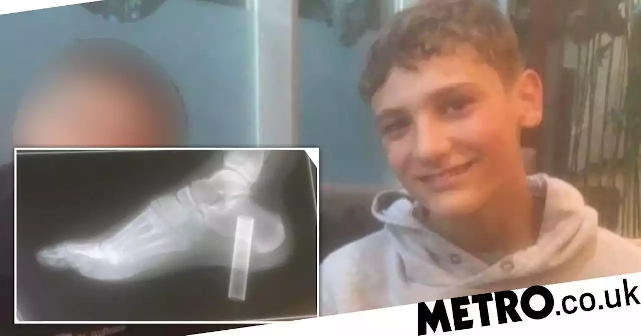 Boy almost lost his foot after he stamped on plastic vape and it impaled him