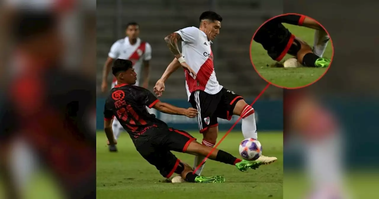 El jugador que fracturó a Kranevitter pidió disculpas: 'No hubo mala intención'