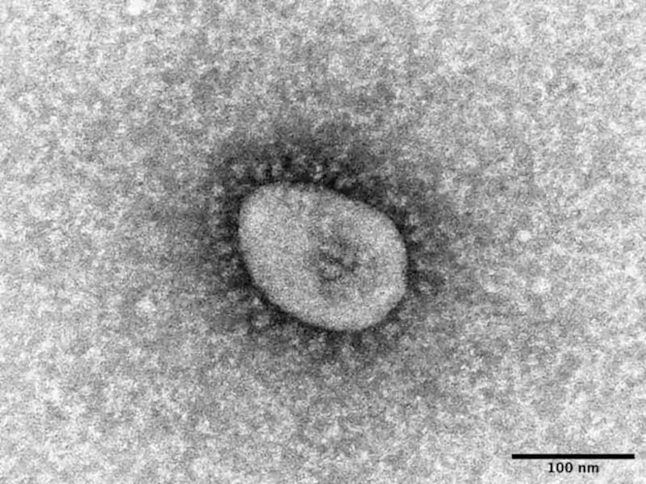 Omicron strain behind China surge now in PH