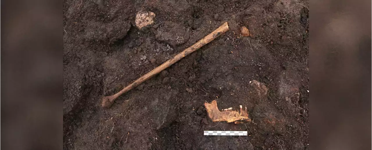 Well-Preserved 'Bog Body' Unearthed in Denmark Might Be Remains of an Ancient Ritual