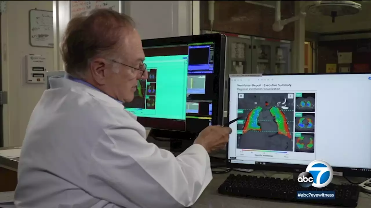 COVID long haulers see new hope from advanced lung-scanning technology