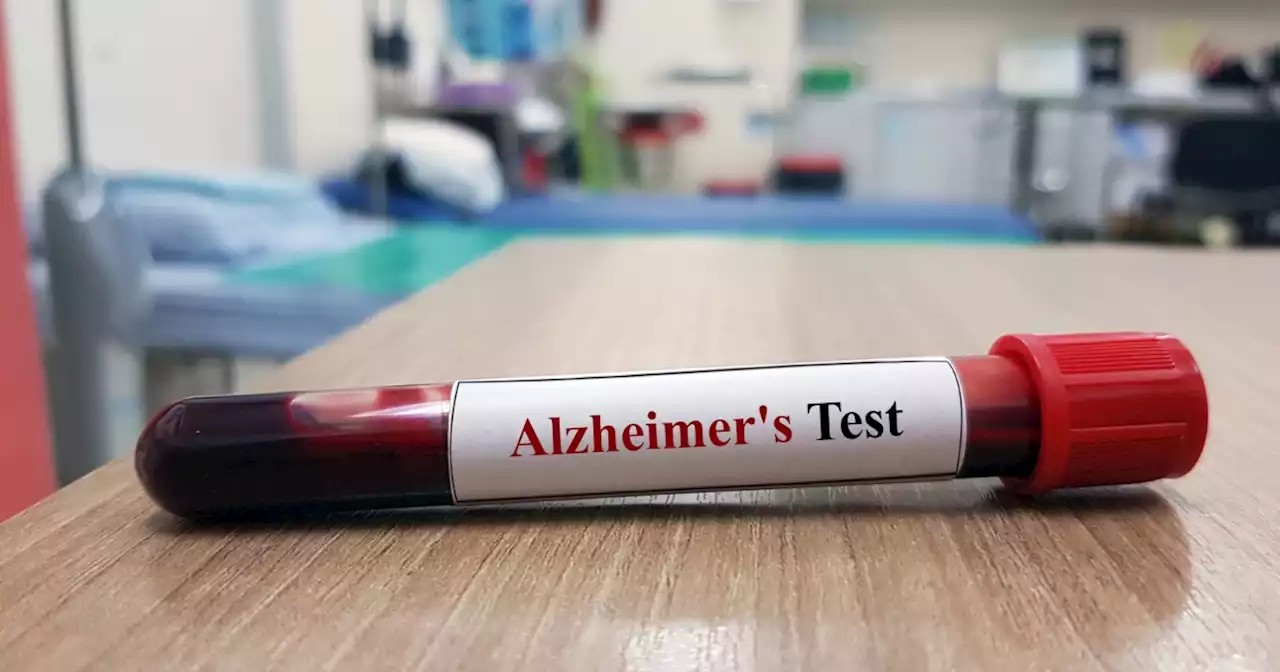 Japan approves Alzheimer's blood test kit