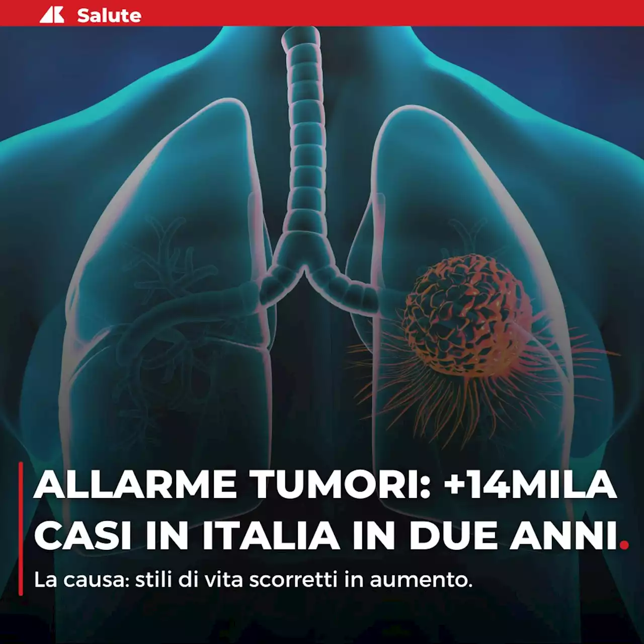 Tumori, nel 2022 in Italia +14mila casi in 2 anni: allarme stili vita scorretti