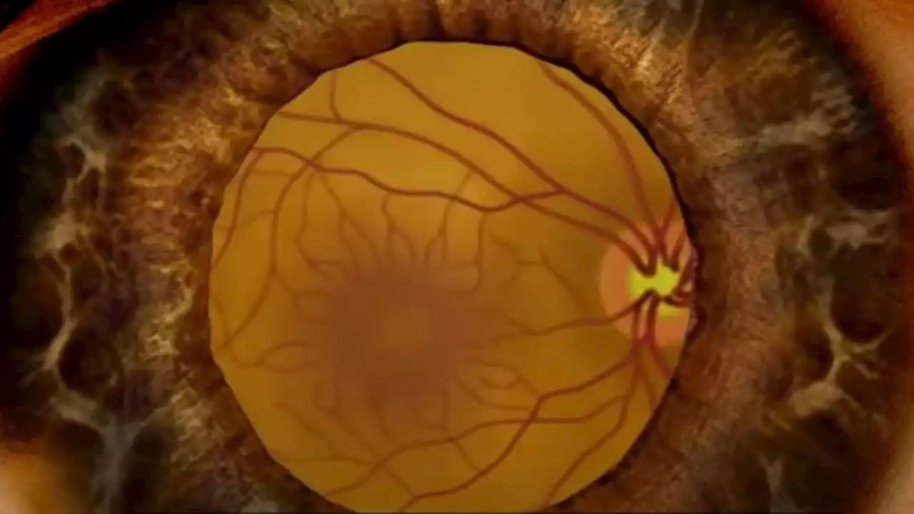 3D-bioprinted eye tissue will help researchers understand blinding diseases